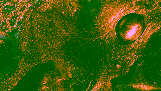 World Gold Council Gold is helping us taking care of our health Ad Commercial Brand Imagery Photoshoot 0