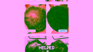 Pilot.com.au 95 of hair loss in men is genetic so what can you do about it Ad Commercial Brand Imagery Photoshoot 2