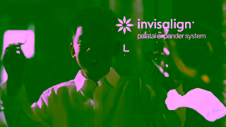Invisalign Start early to help adult teeth fall into the right place Invisalign Palatal Expander System Ad Commercial Brand Imagery Photoshoot 2