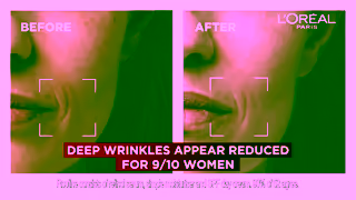 L'Oreal Paris Laser routine Ad Commercial Brand Imagery Photoshoot 2