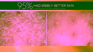 Olay See the Difference with Olay OLAY HYALURONIC BODY WASH Ad Commercial Brand Imagery Photoshoot 1