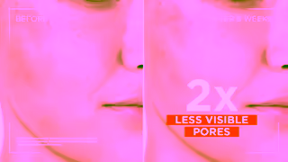 L'Oreal Paris Revitalift Clinical 12 Pure Vitamin C Serum LOral Paris Australia NZ Ad Commercial Brand Imagery Photoshoot 2