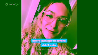 Invisalign Dallas Before and After Invisalign Ad Commercial Brand Imagery Photoshoot 0