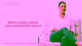 JUVEDERM Multi Awareness aid101674 OLV Glenda Victoria 45s HISPANIC Ad Commercial Brand Imagery Photoshoot 1