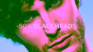 La Roche Posay LRP Effaclar Serum 15 Ad Commercial Brand Imagery Photoshoot 1