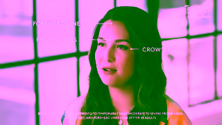 BOTOX Cosmetic BCT157044 SY 2 0 OLV Brenda Ad Commercial Brand Imagery Photoshoot 0