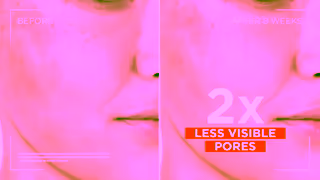 L'Oreal Paris Revitalift Clinical 12 Pure Vitamin C Serum LOral Paris Australia NZ Ad Commercial Brand Imagery Photoshoot 2