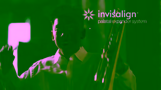 Invisalign Palatal expansion without lifestyle restrictions Invisalign Palatal Expander System Ad Commercial Brand Imagery Photoshoot 2