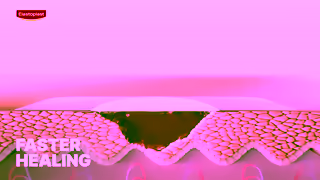 Elastoplast Want TrueView TryNow 16x9 15s Ad Commercial Brand Imagery Photoshoot 1