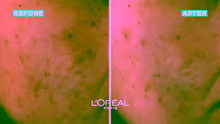 L'Oreal Paris Try the NEW Bright Reveal Niacinamide Dark Spot Serum by LOral Paris Dark Spots Game Over Ad Commercial Brand Imagery Photoshoot 2