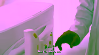 LUMENIS Vision Be THE Doctor to undry some eyes with OptiLIGHT OptiPLUS Ad Commercial Brand Imagery Photoshoot 1