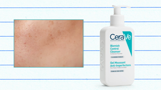 CeraVe Clear It Up Like A Derm with CeraVe Ad Commercial Brand Imagery Photoshoot 1