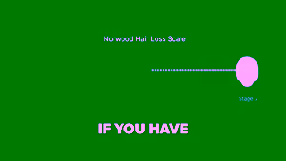 Pilot.com.au Use HAIR50 to start treatment from 25 per month Ad Commercial Brand Imagery Photoshoot 0