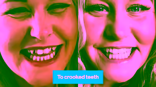 Invisalign InvisalignMythBusting16x915s Invisalign Ad Commercial Brand Imagery Photoshoot 1