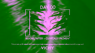 Vichy DERCOS Anti Dandruff DS Shampoo Ad Commercial Brand Imagery Photoshoot 1