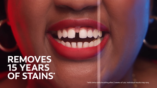 Colgate Colgate Optic White Removes 15 Years of Stains Ad Commercial Brand Imagery Photoshoot 1